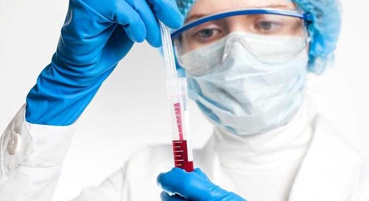 Accu Labs